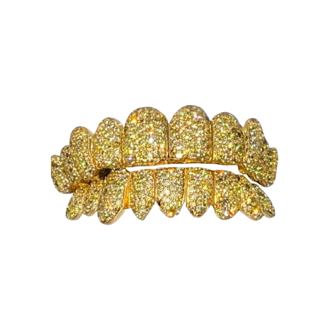 Custom Canary Hand Set Diamond Grillz (Zigzag setting) · Cali Jewelers