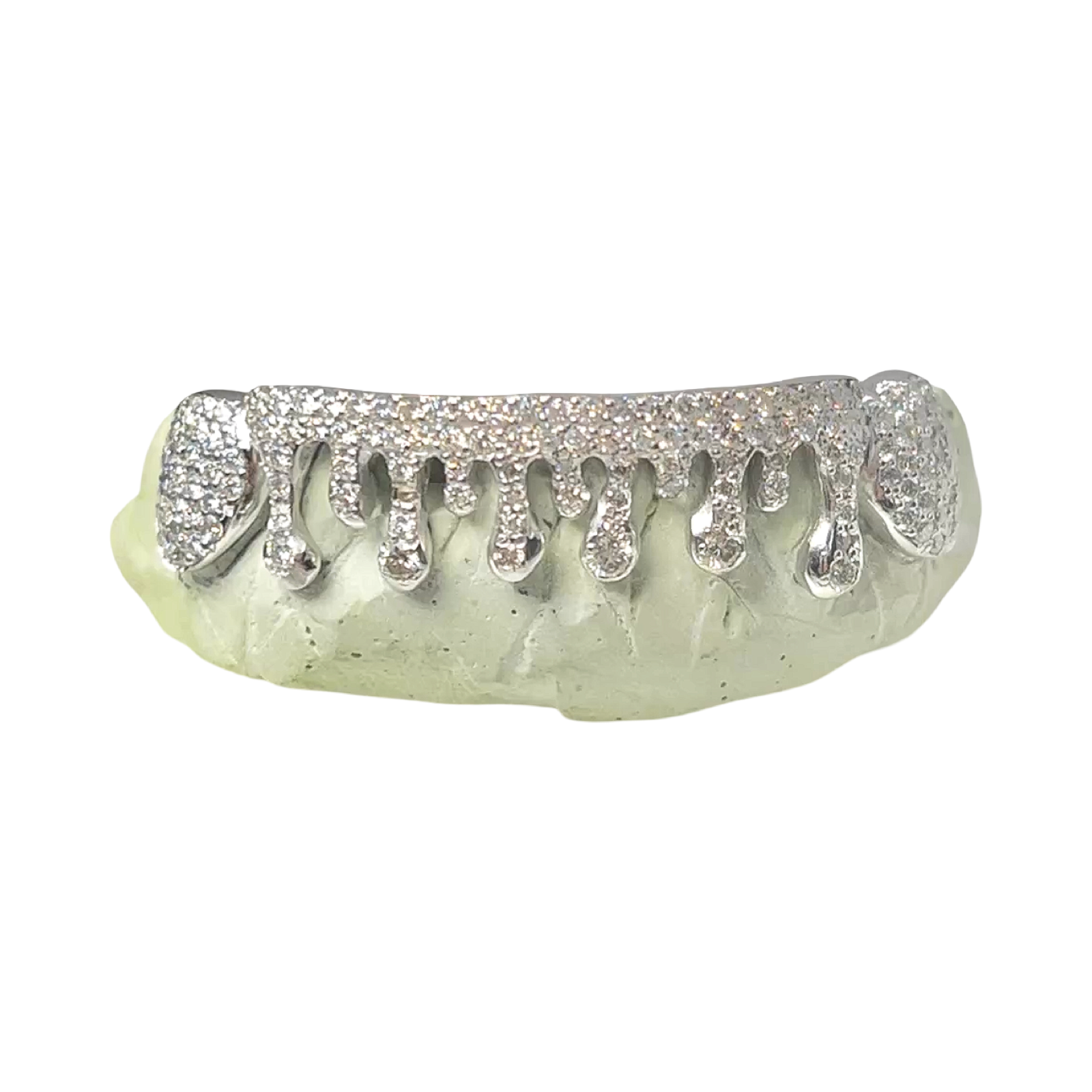 Custom 8 Piece Fully Iced Diamond Drip Grillz