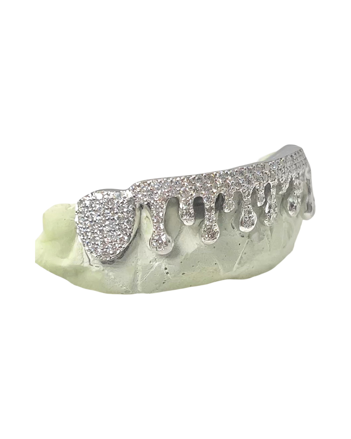 Custom 8 Piece Fully Iced Diamond Drip Grillz
