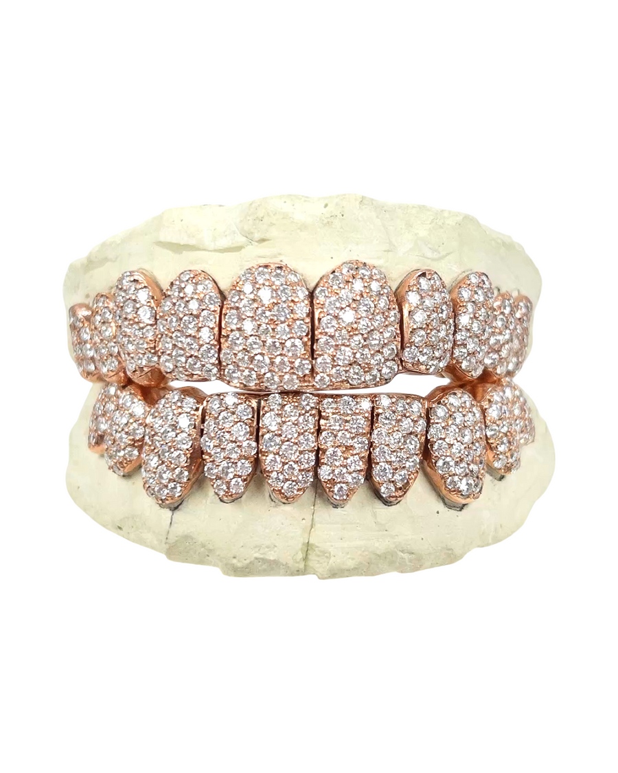 Custom VVS1 Clarity Hand Set All Natural Diamond Grillz Jumbo Setting