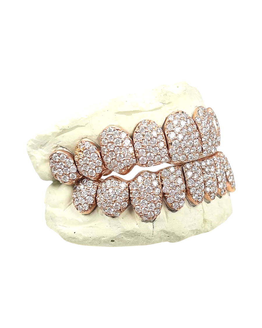 Custom VVS1 Clarity Hand Set All Natural Diamond Grillz Jumbo Setting