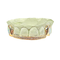 Custom Diamond Bar Grillz with Opal Fangs