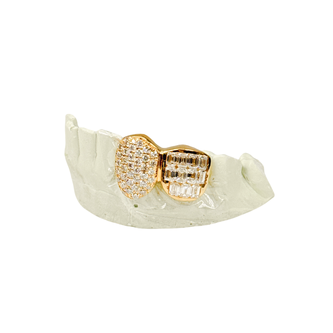 Custom round diamond zigzag + emerald tooth diamond grillz