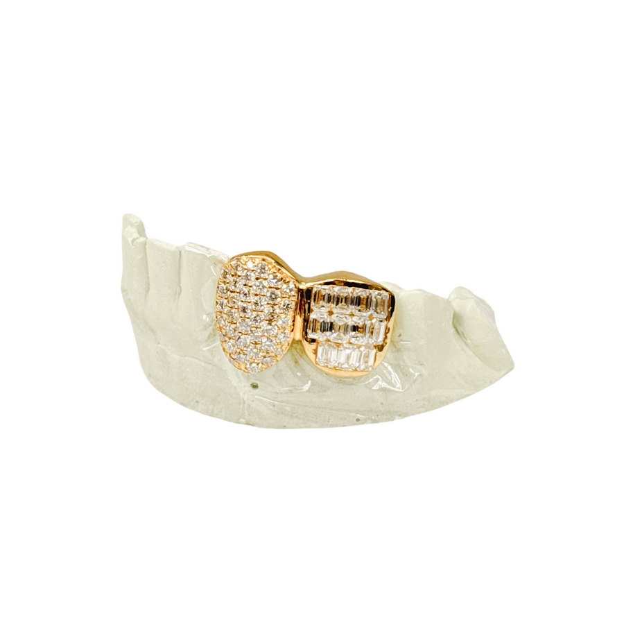 Custom round diamond zigzag + emerald tooth diamond grillz