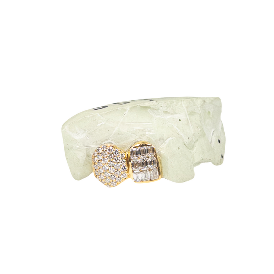 Custom round diamond zigzag + emerald tooth diamond grillz