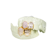 Custom round diamond zigzag + emerald tooth diamond grillz