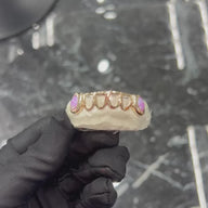 Custom Open Face Grillz with Opal Fangs