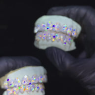 Custom VS1 Clarity Hand Set All Natural Diamond Grillz (Zigzag/Honeycomb setting)