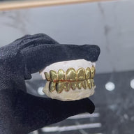 SPECIAL: Custom Solid Gold Grillz