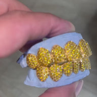 Custom Canary Hand Set Diamond Grillz (Straight Setting)