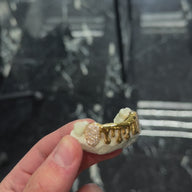 Custom 6 piece Drip Grillz with Diamond Fangs