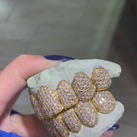 Custom I Clarity Hand Set All Natural Diamond Grillz (Zigzag/Honeycomb setting)