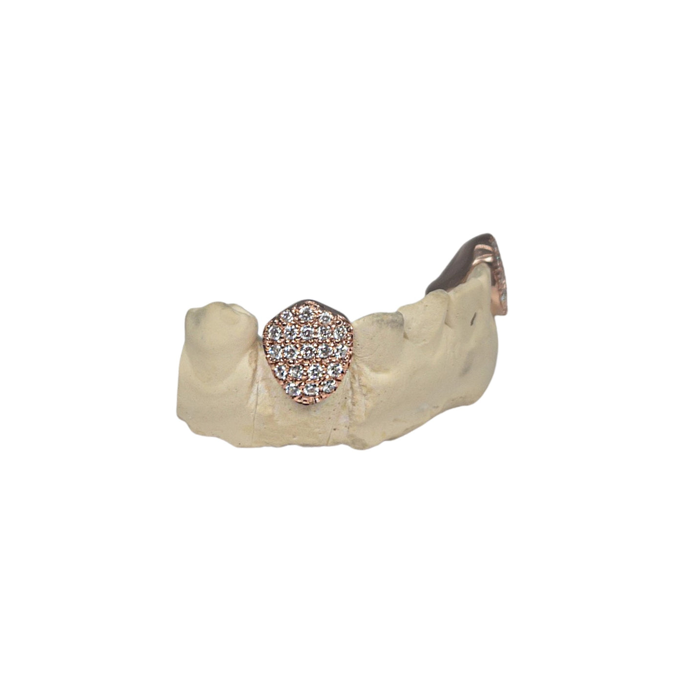 Custom Natural Diamond Single Tooth Grillz (Straight setting)