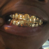 SPECIAL: Custom Solid Gold Grillz