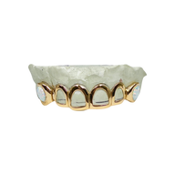 Custom Open Face Grillz with Opal Fangs