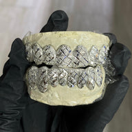 Custom Diamond Dust Diamond Cuts Gold Grillz